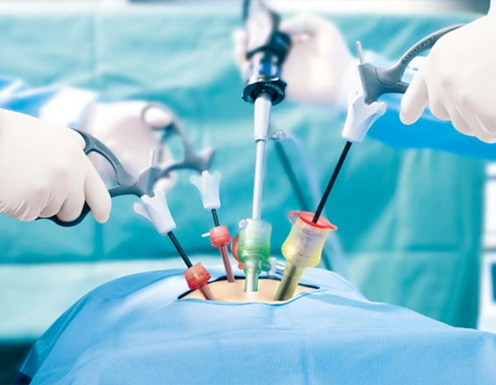 Surgical Sector laparoskopiki