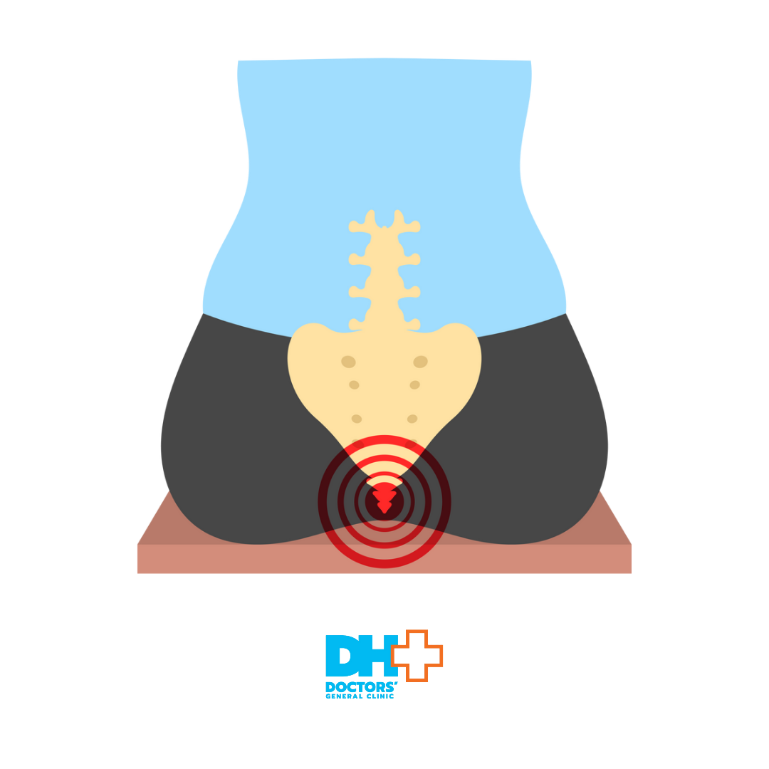 Κύστη Κόκκυγος