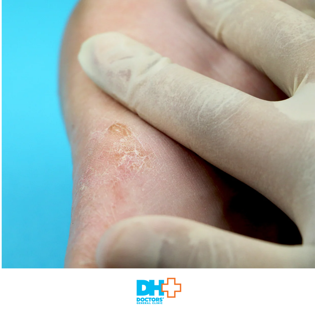 λοιμώξεις δέρματος και μαλακών μορίων